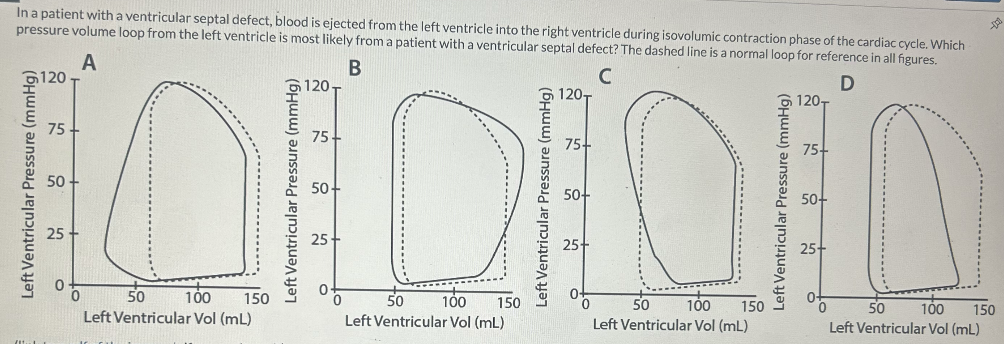 In a patient with a ventricular septal defect, blood is ejected from the left ventricle into the right ventricle during isovolumic contraction phase of the cardiac cycle. Which
pressure volume loop from the left ventricle is most likely from a patient with a ventricular septal defect? The dashed line is a normal loop for reference in all figures.
A
120
B
120
C
120-
D
120-
75
50-
25
50
100
Left Ventricular Vol (mL)
75-
50
25
75+
50+
25+
150
50
100
150
50
100
150
Left Ventricular Vol (mL)
Left Ventricular Vol (mL)
75+
50+
25+
50
100 150
Left Ventricular Vol (mL)
-000